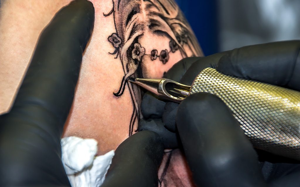 Why Tattoo Removal Is Profitable | Tattoo Removal Insurance